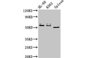 Western Blot Positive WB detected in: HL60 whole cell lysate, K562 whole cell lysate, Mouse spleen tissue All lanes: API5 antibody at 3 μg/mL Secondary Goat polyclonal to rabbit IgG at 1/50000 dilution Predicted band size: 60, 50, 57, 51, 58 kDa Observed band size: 60, 50 kDa