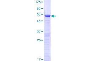 OTUD6B Protein (AA 1-293) (GST tag)