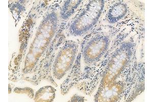 ABIN6258982 and ABIN6276068 at 1/100 staining human normal colon tissue by IHC-P.