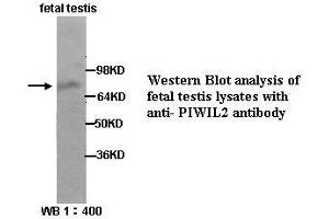 Image no. 1 for anti-Piwi-Like 2 (PIWIL2) (Internal Region) antibody (ABIN790870) (PIWIL2 Antikörper  (Internal Region))