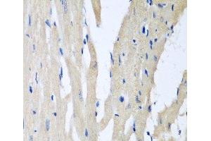 Immunohistochemistry of paraffin-embedded Rat heart using PITRM1 Polyclonal Antibody at dilution of 1:100 (40x lens). (PITRM1 Antikörper)