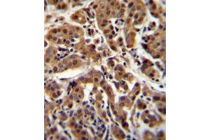 Immunohistochemistry (Paraffin-embedded Sections) (IHC (p)) image for anti-V-Akt Murine Thymoma Viral Oncogene Homolog 1 (AKT1) (AA 428-457), (C-Term) antibody (ABIN655915)