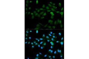 Immunofluorescence analysis of MCF7 cell using CYP11A1 antibody. (CYP11A1 Antikörper)