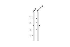 Lane 1: A431, Lane 2: NCI-H292 cell lysate at 20 µg per lane, probed with bsm-51386M SERPINB3 (798CT5.