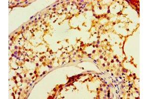 Immunohistochemistry of paraffin-embedded human testis tissue using CHRFAM7A Antibody at a dilution of 1:100. (CHRFAM7A Antikörper  (AA 1-150))