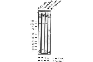 Western Blotting (WB) image for anti-phospholipase C, gamma 1 (PLCG1) (pTyr783) antibody (ABIN6256803)