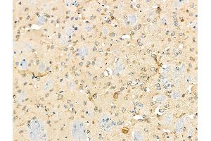 ABIN6259458 and ABIN6275227 at 1/100 staining Mouse brain tissue by IHC-P. (MBTPS1 Antikörper  (Internal Region))