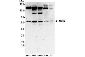 Western Blotting (WB) image for anti-N-Myristoyltransferase 2 (NMT2) (AA 100-150) antibody (ABIN7453142)