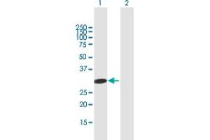 Western Blot analysis of ADAL expression in transfected 293T cell line by ADAL MaxPab polyclonal antibody.