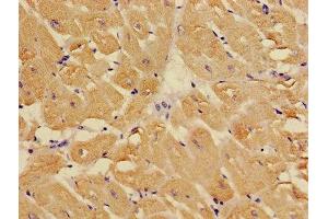 Immunohistochemistry of paraffin-embedded human heart tissue using ABIN7173569 at dilution of 1:100 (TNNC1 Antikörper  (AA 11-149))