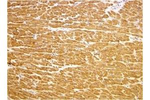 Immunohistochemistry (IHC) image for anti-Toll-Interleukin 1 Receptor (TIR) Domain Containing Adaptor Protein (TIRAP) (C-Term) antibody (ABIN1030739) (TIRAP Antikörper  (C-Term))