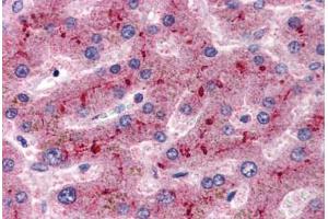 Human Liver (formalin-fixed, paraffin-embedded) stained with CFH antibody ABIN337307 at 2. (Complement Factor H Antikörper  (AA 577-588))