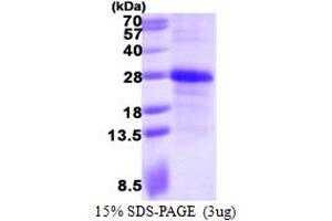 SDS-PAGE (SDS) image for Ephrin A1 (EFNA1) (AA 19-182) protein (His tag) (ABIN667976) (Ephrin A1 Protein (EFNA1) (AA 19-182) (His tag))