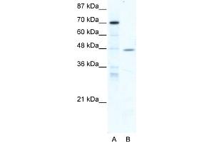 Western Blotting (WB) image for anti-Nuclear Receptor Subfamily 2, Group F, Member 6 (NR2F6) (Middle Region) antibody (ABIN2777699)