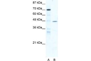 WB Suggested Anti-NR2F6 Antibody Titration:  5. (NR2F6 Antikörper  (Middle Region))