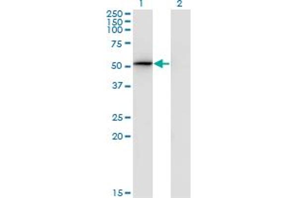 PSMD4/ASF Antikörper  (AA 1-110)