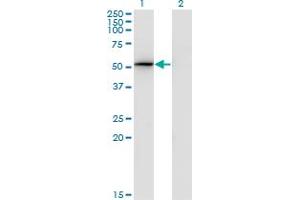 Western Blot analysis of PSMD4 expression in transfected 293T cell line by PSMD4 monoclonal antibody (M01), clone 3C9.