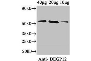 Western Blot Positive WB detected in: Arabidopsis thaliana (40 μg, 20 μg, 10 μg) All lanes: DEGP12 antibody at 3. (DEGP12 Antikörper  (AA 25-499))