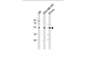 All lanes : Anti-ENT1(Slc29a1)-Ps254 at 1:500-1000 dilution Lane 1: 293 whole cell lysate Lane 2: MDA-MB-453 whole cell lysate Lane 3: Mouse lung tissue lysate Lysates/proteins at 20 μg per lane. (SLC29A1 Antikörper  (AA 232-260))