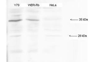Human; HMX1 antibody - middle region validated by WB using Y79, WERI-(human retinoblastoma cell lines), HeLa-(human papilloma virus cell line) at 1:1000. (HMX1 Antikörper  (Middle Region))