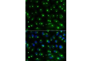 Immunofluorescence analysis of MCF-7 cells using GGA2 antibody. (GGA2 Antikörper)