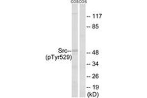 Western blot analysis of extracts from COS7 cells treated with PMA 125ng/ml 30', using Src (Phospho-Tyr529) Antibody. (Src Antikörper  (pTyr530))
