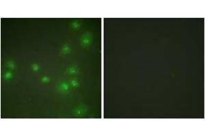 Immunofluorescence analysis of HuvEc cells, using ZNF265 Antibody. (ZNF265 Antikörper  (AA 106-155))