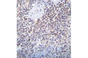 Immunohistochemistry (Paraffin-embedded Sections) (IHC (p)) image for anti-Protein Associated with Topoisomerase II Homolog 2 (PATL2) (AA 165-196), (Middle Region) antibody (ABIN954004)