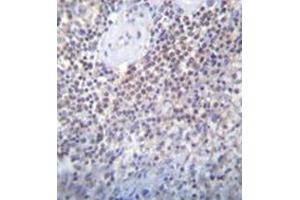 Immunohistochemistry analysis in formalin fixed and paraffin embedded human spleen tissue reacted with PATL2 Antibody (Center) followed which was peroxidase conjugated to the secondary antibody and followed by DAB staining. (PATL2 Antikörper  (Middle Region))