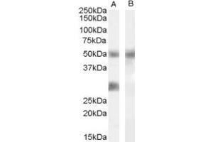 Western Blotting (WB) image for anti-Insulin-Like Growth Factor Binding Protein 3 (IGFBP3) (AA 191-205) antibody (ABIN303875) (IGFBP3 Antikörper  (AA 191-205))
