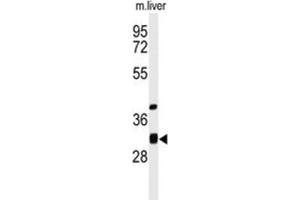 Western Blotting (WB) image for anti-Enoyl CoA Hydratase Domain Containing 1 (ECHDC1) antibody (ABIN3004267) (ECHDC1 Antikörper)