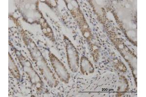 Image no. 2 for anti-V-Akt Murine Thymoma Viral Oncogene Homolog 2 (AKT2) (AA 100-189) antibody (ABIN599349) (AKT2 Antikörper  (AA 100-189))
