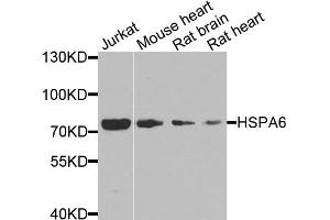 Western blot analysis of extracts of various cell lines, using HSPA6 antibody. (HSPA6 Antikörper)