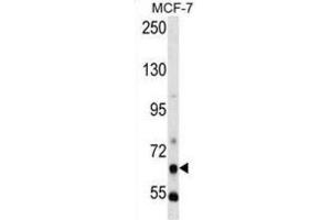 Western Blotting (WB) image for anti-phosphoenolpyruvate Carboxykinase 1 (Soluble) (PCK1) antibody (ABIN3003679) (PCK1 Antikörper)