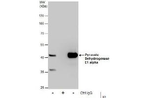 IP Image Immunoprecipitation of Pyruvate Dehydrogenase E1 alpha protein from HepG2 whole cell extracts using 5 μg of Pyruvate Dehydrogenase E1 alpha antibody, Western blot analysis was performed using Pyruvate Dehydrogenase E1 alpha antibody, EasyBlot anti-Rabbit IgG  was used as a secondary reagent. (Pyruvate Dehydrogenase E1 alpha (Center) Antikörper)