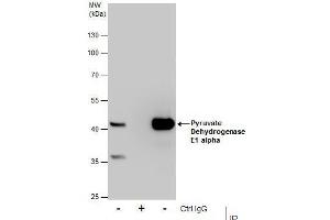 IP Image Immunoprecipitation of Pyruvate Dehydrogenase E1 alpha protein from HepG2 whole cell extracts using 5 μg of Pyruvate Dehydrogenase E1 alpha antibody, Western blot analysis was performed using Pyruvate Dehydrogenase E1 alpha antibody, EasyBlot anti-Rabbit IgG  was used as a secondary reagent.