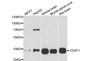 Western blot analysis of extracts of various cell lines, using GDAP1 antibody. (GDAP1 Antikörper  (AA 1-225))