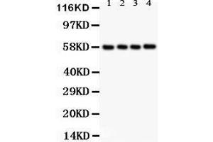 Anti- PKM2 Picoband antibody, Western blotting All lanes: Anti PKM2  at 0. (PKM Antikörper  (N-Term))