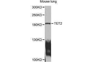 Western blot analysis of extracts of mouse lung, using TET2 antibody (ABIN1875061) at 1:1000 dilution. (TET2 Antikörper)