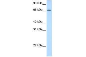 WB Suggested Anti-ADAT1 Antibody Titration:  0. (ADAT1 Antikörper  (C-Term))