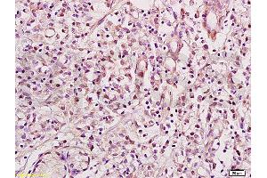 Immunohistochemistry (IHC) image for anti-RE1-Silencing Transcription Factor (REST) (AA 401-450) antibody (ABIN747683)