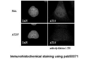 Image no. 2 for anti-Ataxia Telangiectasia Mutated (ATM) (C-Term) antibody (ABIN363380) (ATM Antikörper  (C-Term))