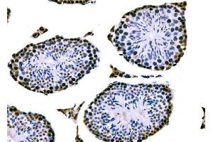 IHC analysis of RRS1 using anti-RRS1 antibody (ABIN7601344). (RRS1 Antikörper  (AA 33-266))