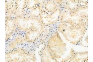 ABIN6257804 and ABIN6275422 at 1/100 staining human normal kidney tissue by IHC-P.