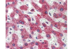 Immunohistochemistry (IHC) image for anti-Hydroxysteroid (11-Beta) Dehydrogenase 1 (HSD11B1) (N-Term) antibody (ABIN2773867) (HSD11B1 Antikörper  (N-Term))