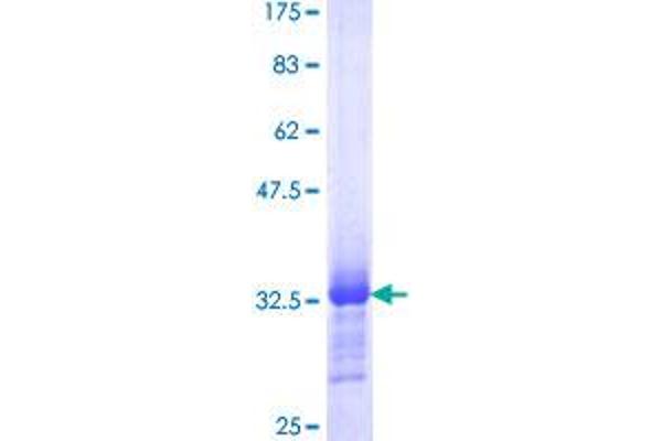 SMARCE1 Protein (AA 75-142) (GST tag)