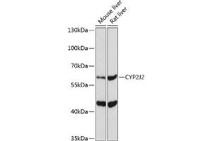 Western blot analysis of extracts of various cell lines, using CYP2J2 Antibody (ABIN6134306, ABIN6139339, ABIN6139340 and ABIN6221491) at 1:1000 dilution. (CYP2J2 Antikörper  (AA 200-300))