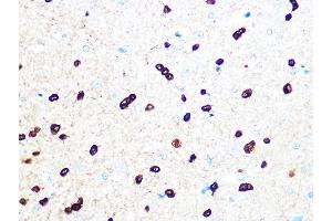 Immunohistochemistry of paraffin-embedded rat brain using TPPP/p25 Rabbit mAb (ABIN7271031) at dilution of 1:100 (40x lens). (Tppp Antikörper)