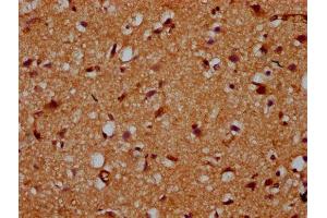 IHC image of ABIN7163112 diluted at 1:200 and staining in paraffin-embedded human brain tissue performed on a Leica BondTM system. (CDS2 Antikörper  (AA 354-445))