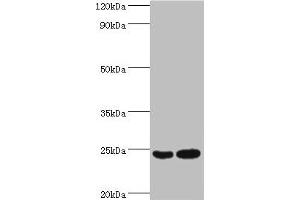 Western blot All lanes: RAN antibody at 2 μg/mL Lane 1: Hela whole cell lysate Lane 2: Jurkat whole cell lysate Secondary Goat polyclonal to rabbit IgG at 1/10000 dilution Predicted band size: 24 kDa Observed band size: 24 kDa (RAN Antikörper  (AA 1-216))